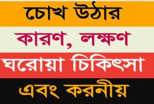 Conjunctivitis কী চোখ ওঠা রোগের কারন কী চোখ উঠলে করনীয় এবং এর প্রতিকার।