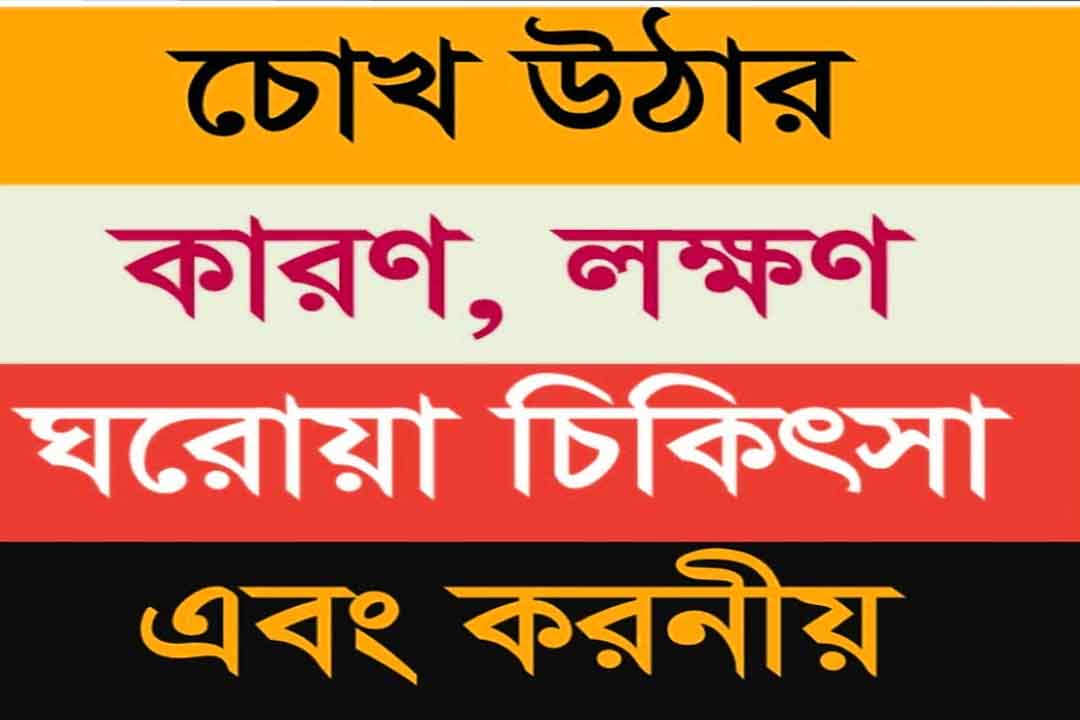 Conjunctivitis কী চোখ ওঠা রোগের কারন কী চোখ উঠলে করনীয় এবং এর প্রতিকার।